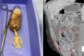 ofkesi-basina-is-acti!-yedigi-prezervatife-sarili-muz-yuzunden-canindan-oluyordu