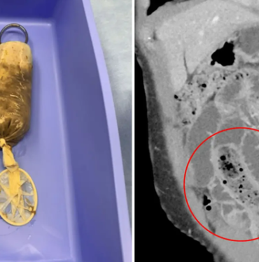 ofkesi-basina-is-acti!-yedigi-prezervatife-sarili-muz-yuzunden-canindan-oluyordu