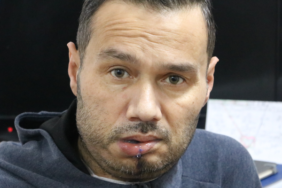 her-sey-agzinda-gecmeyen-ufak-bir-yarayla-basladi!-cenesi-kesilerek-kaval-kemiginden-parca-takildi