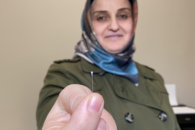 hapsirmasiyla-igneyi-yutmasi-bir-oldu!-yasadigi-sokla-aci-icinde-kaldi