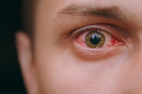 uzmanlardan-onemli-uyari!-giderek-yayilan-salgin-antibiyotige-karsi-duyarli