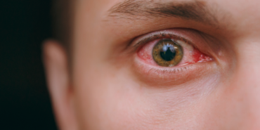 uzmanlardan-onemli-uyari!-giderek-yayilan-salgin-antibiyotige-karsi-duyarli