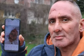 sinek-isirigiyla-hayatinin-kabusunu-yasadi!-yuzu-taninamayacak-hale-geldi