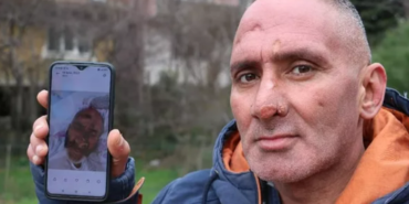 sinek-isirigiyla-hayatinin-kabusunu-yasadi!-yuzu-taninamayacak-hale-geldi