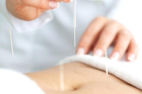 akupunktur-ile-zayiflanir-mi?-akupunktur-ile-nasil-kilo-verilir,-metabolizmayi-hizlandirir-mi?