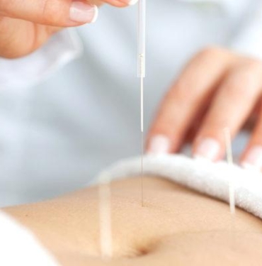 akupunktur-ile-zayiflanir-mi?-akupunktur-ile-nasil-kilo-verilir,-metabolizmayi-hizlandirir-mi?