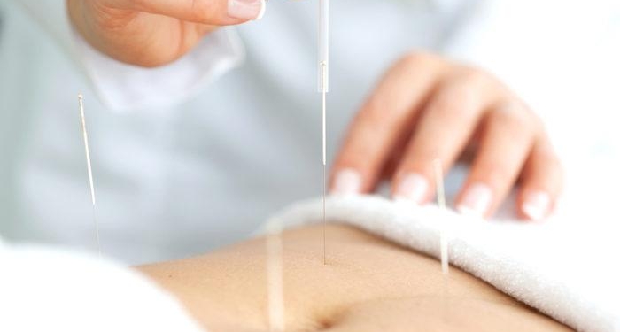 Akupunktur ile zayıflanır mı? Akupunktur ile nasıl kilo verilir, metabolizmayı hızlandırır mı?