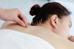 akupunktur-ile-sigara-birakilir-mi,-akupunktur-ile-sigara-birakma-yontemi-nedir?-akupunktur-ile-sigara-birakma-tedavisi-nasil-yapilir?