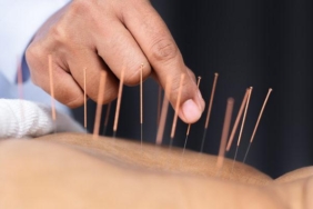 akupunkturun-yan-etkileri-nelerdir,-zarari-var-mi?-kimlere-akupunktur-tedavisi-uygulanmamali,-bas-agrisi-yapar-mi?