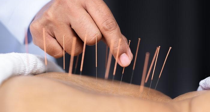 akupunkturun-yan-etkileri-nelerdir,-zarari-var-mi?-kimlere-akupunktur-tedavisi-uygulanmamali,-bas-agrisi-yapar-mi?