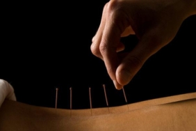 cinsel-saglik-icin-akupunktur-nasil-kullanilir,-cinsel-tedavi-nasil-yapilir?-akupunktur-cinsel-sagliga-iyi-gelir-mi,-cinsel-akupunktur-noktalari-nelerdir?