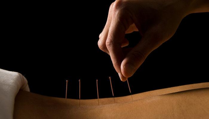 cinsel-saglik-icin-akupunktur-nasil-kullanilir,-cinsel-tedavi-nasil-yapilir?-akupunktur-cinsel-sagliga-iyi-gelir-mi,-cinsel-akupunktur-noktalari-nelerdir?