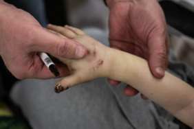 deprem-bolgesinde-enfeksiyon-riskine-dikkat!-enfeksiyondan-korunmak-icin-alinmasi-gereken-onlemler