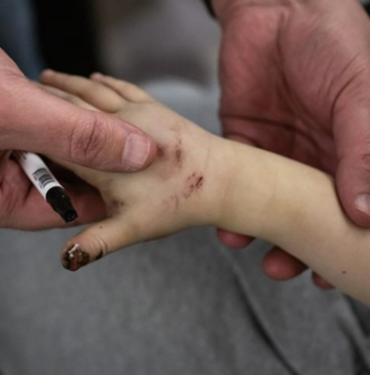 deprem-bolgesinde-enfeksiyon-riskine-dikkat!-enfeksiyondan-korunmak-icin-alinmasi-gereken-onlemler