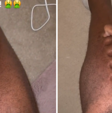 sessiz-katil’in-onemli-belirtisi!-oyun-hamuruna-donen-adam-yasadiklarini-paylasti