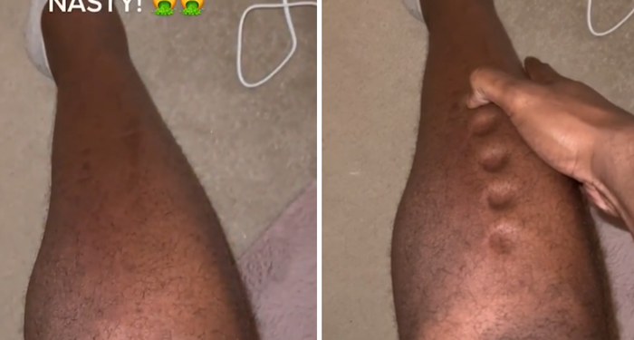 Sessiz katil’in önemli belirtisi! Oyun hamuruna dönen adam yaşadıklarını paylaştı