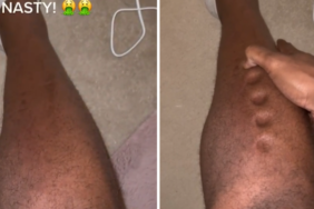 sessiz-katil’in-onemli-belirtisi!-vucudu-oyun-hamuruna-donen-adam-yasadiklarini-paylasti