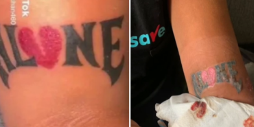 hijyensizligin-sonu-kotu-bitti!-yaptirdigi-dovme-bir-anda-curumeye-basladi