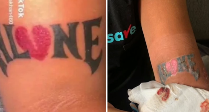 Hijyensizliğin sonu kötü bitti! Yaptırdığı dövme bir anda çürümeye başladı