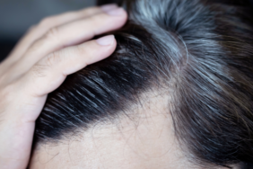 genetik-diyerek-gecistirmeyin!-sac-beyazlamasi-ciddi-hastaligin-belirtisi-olabilir