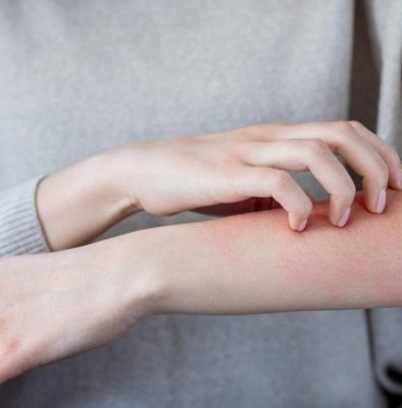 egzamaya-ne-iyi-gelir,-nasil-gecer?-egzamaya-iyi-gelen-dogal-yontemler-nedir,-bitkisel-tedavi-onerileri