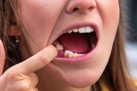 belcika’da-kadin-calisan-disleri-nedeniyle-ilk-is-gununde-isten-cikarildi