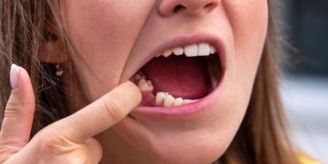 belcika’da-kadin-calisan-disleri-nedeniyle-ilk-is-gununde-isten-cikarildi