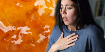 severek-yiyoruz-ama-siddetli-ataklara-neden-olabiliyor!-uzmanlar-reflu-riskine-karsi-uyariyor