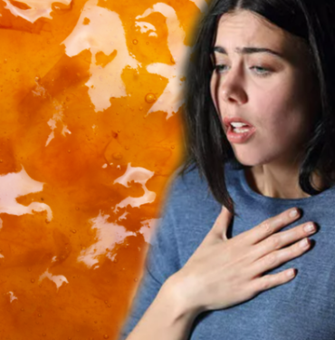 severek-yiyoruz-ama-siddetli-ataklara-neden-olabiliyor!-uzmanlar-reflu-riskine-karsi-uyariyor