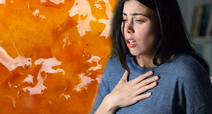 Severek yiyoruz ama şiddetli ataklara neden olabiliyor! Uzmanlar reflü riskine karşı uyarıyor