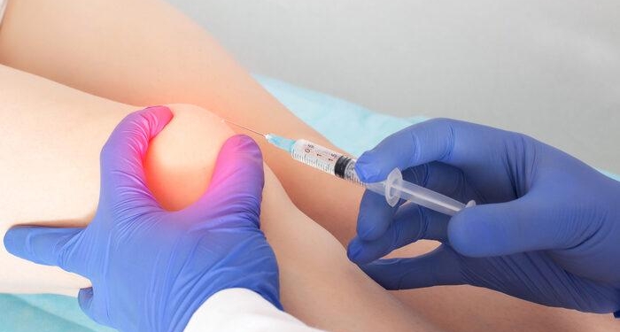 Dize ozon tedavisi nasıl yapılır, diz kireçlenmesinde ozon tedavisi nedir? Diz ağrısında ozon tedavisi işe yarar mı, ağrıyı geçirir mi?