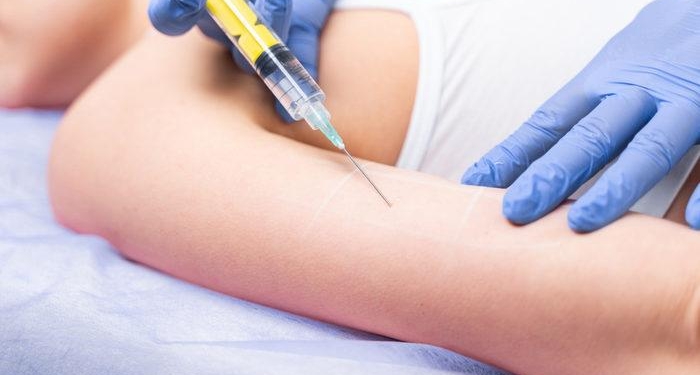 Ozon tedavisinden önce ve sonra nelere dikkat etmek gerekir? Ozon tedavisi nasıl olur, ne kadar sürer?