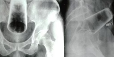 sarhosken-icine-soktugu-maddeyi-goren-doktorlar-sok-oldu!-itirafi-olay-yaratti