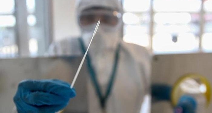 Çinli bilim insanlarından Kovid-19 açıklaması! 1300’den fazla numune alındı: “İhtimal yüksek…”