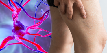 felc-gecirmeden-aylar-once-ortaya-cikan-belirti!-bu-semptomu-fark-etmek-hayatinizi-kurtarabilir…