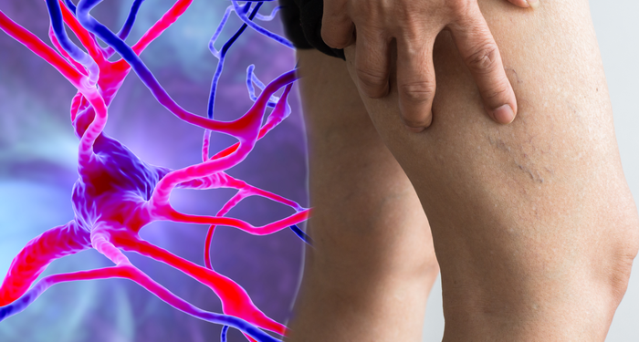 Felç geçirmeden aylar önce ortaya çıkan belirti! Bu semptomu fark etmek hayatınızı kurtarabilir…