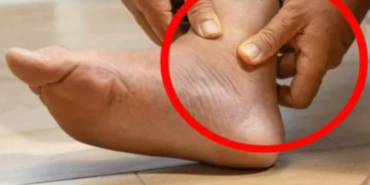 bacak-agrisi-deyip-gecmeyin!-kalp-hastaliginin-bilinmeyen-5-belirtisi