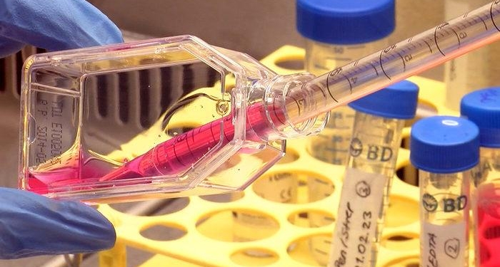 Kanseri can evinden vuracak çalışma! Tedaviyi önce laboratuvarda deniyorlar