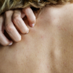 karaciger-kanserinin-bilinmeyen-belirtisi!-ozellikle-geceleri-artis-goruluyor…