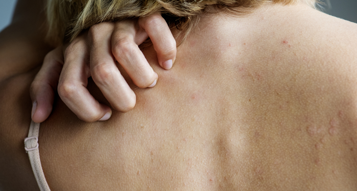 Karaciğer kanserinin bilinmeyen belirtisi! Özellikle geceleri artış görülüyor…