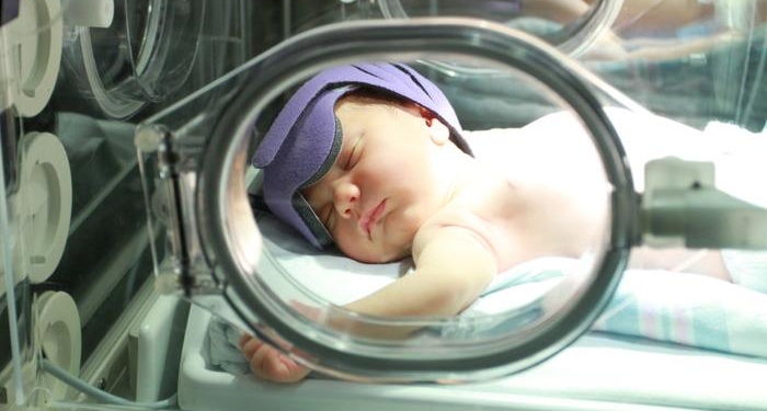 Bebeklerde sarılık nedir, neden olur? Sarılık olan bebeğe ne yapılır, nasıl anlaşılır?