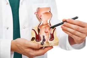 basur-memesi-nasil-gecer,-ne-iyi-gelir?-dis-basur-memesi-kendiliginden-gecer-mi,-neden-olur?