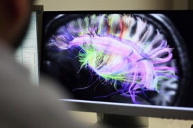 bilim-insanlarindan-kronik-agrilarin-beyindeki-kaynagini-inceleyen-calisma:-hastalara-umut-olabilir