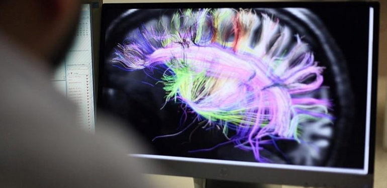 Bilim insanlarından kronik ağrıların beyindeki kaynağını inceleyen çalışma: Hastalara umut olabilir