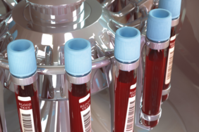 japon-bilim-insanlari-acikladi!-kan-grubunuza-gore-karakter-ozellikleriniz-ve-hastalik-riskleriniz!-iste-en-zeki-kan-grubu…