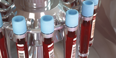 japon-bilim-insanlari-acikladi!-kan-grubunuza-gore-karakter-ozellikleriniz-ve-hastalik-riskleriniz!-iste-en-zeki-kan-grubu…