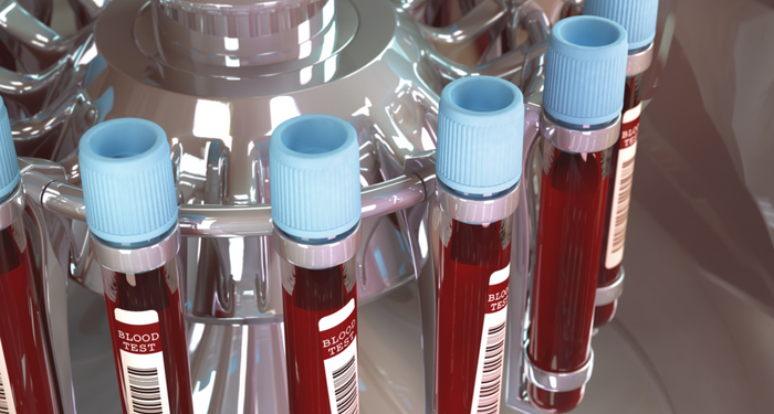 Japon bilim insanları açıkladı! Kan grubunuza göre karakter özellikleriniz ve hastalık riskleriniz! İşte en zeki kan grubu…